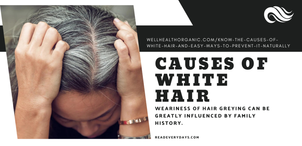 Causes of White Hair